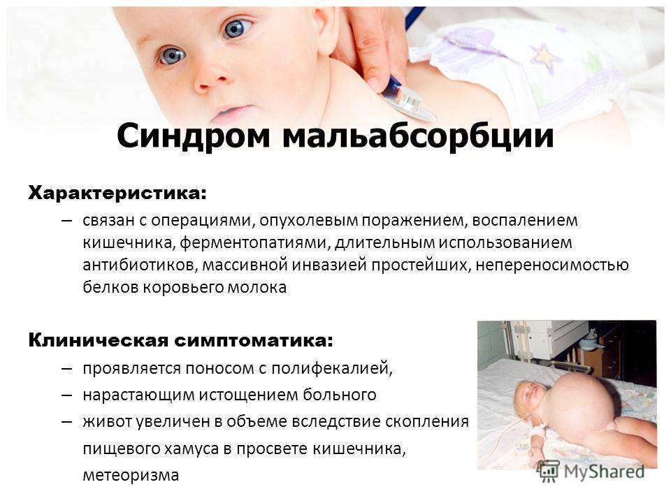 Симптом грефе: причины синдрома, способы выявления и лечения