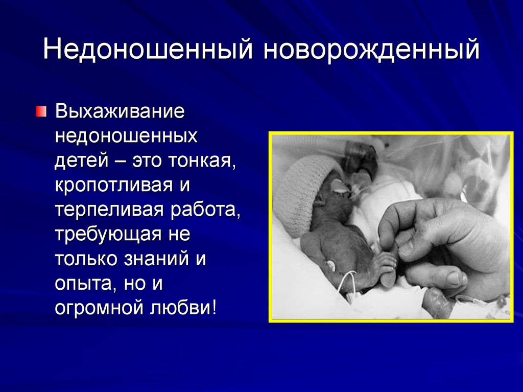 Недоношенный ребенок: последствия в будущем