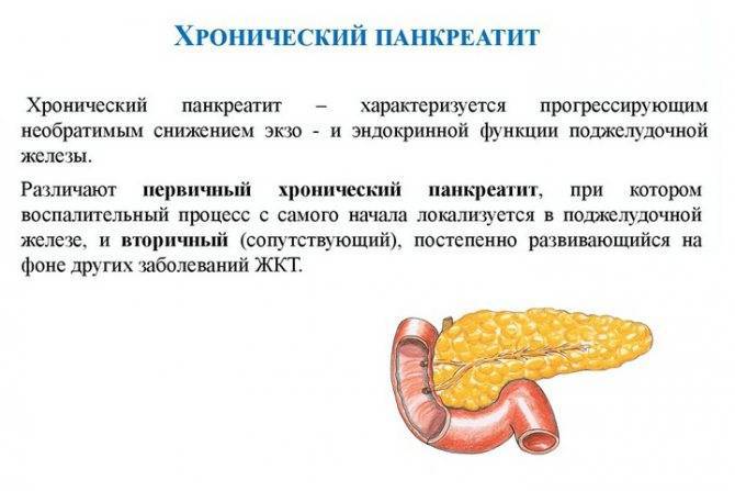 Признаки и симптомы панкреатита при беременности. обострение панкреатита во время беременности — что делать. лечение панкреатита при беременности