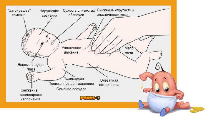Почему новорожденный кряхтит и тужится во сне – что делать?