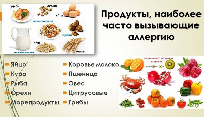 Пищевая аллергия у детей - симптомы, способы лечения, диета