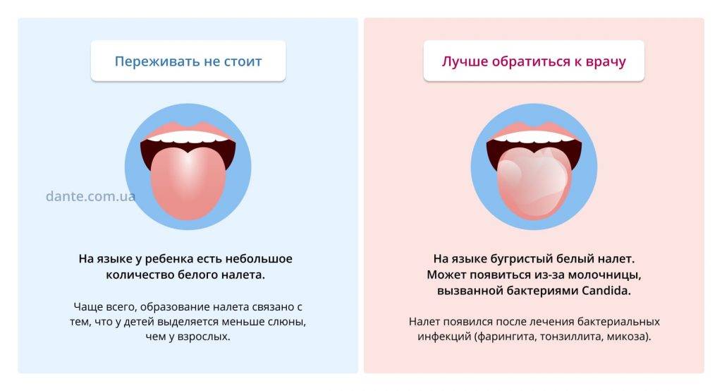 Белый налет на язуке у ребенка при грудном вскармливание