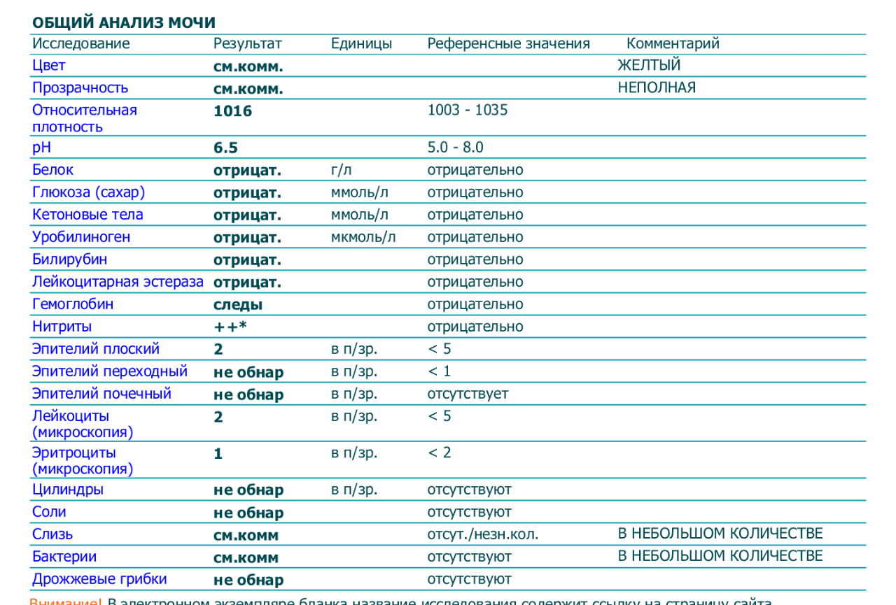 Форум ед. Лейкоцитарная эстераза в моче 75. Общий анализ мочи норма пример. Анализ мочи Результаты норма. Образец общего анализа мочи норма.