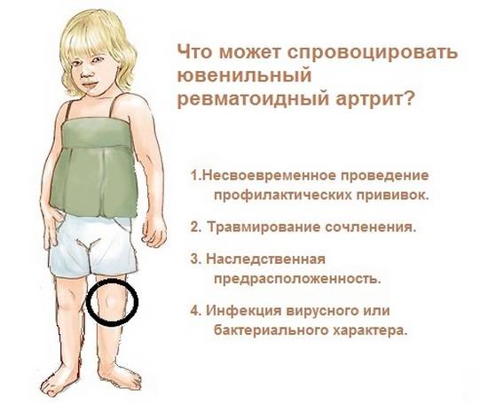 Реактивный артрит у детей: причины, симптомы и лечение