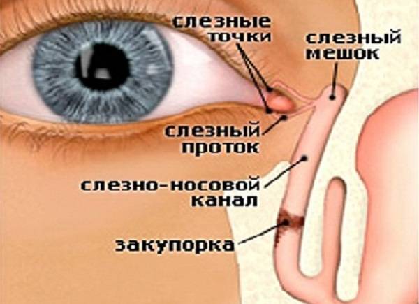 Совет доктора комаровского по лечению дакриоцистита у новорожденных | vizhunasto.ru