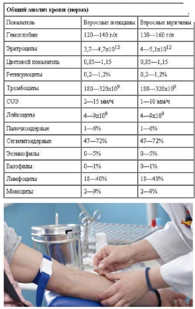 Как берут кровь из вены у грудничка и как подготовиться к анализу