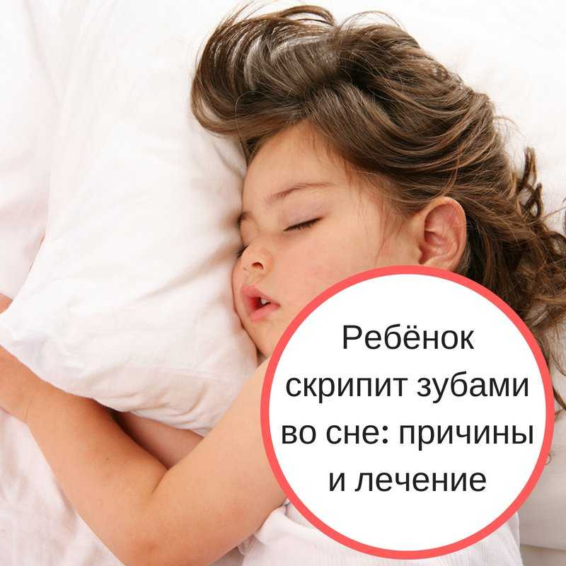 Приступы бруксизма у детей