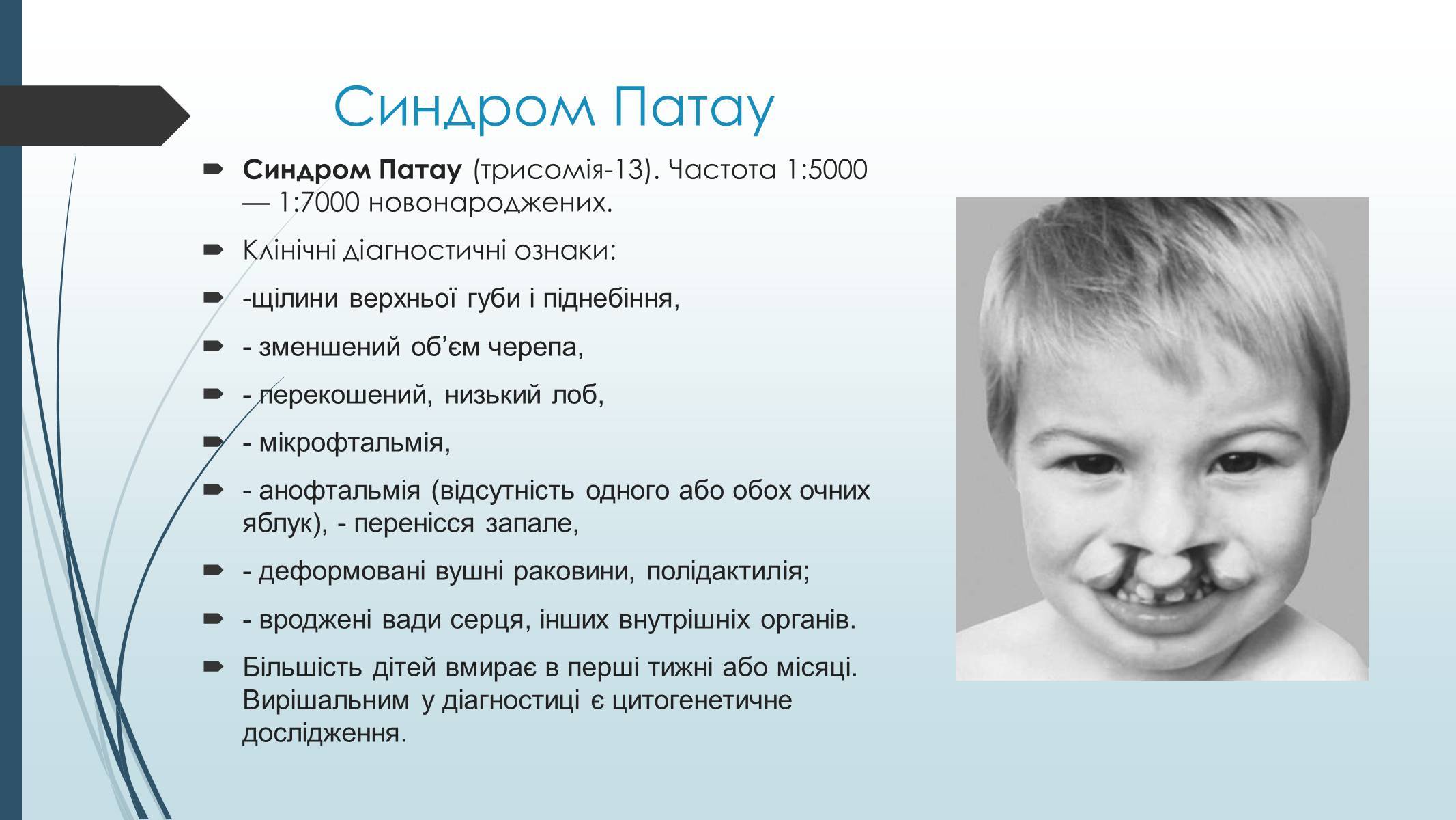 Синдром патау картинки