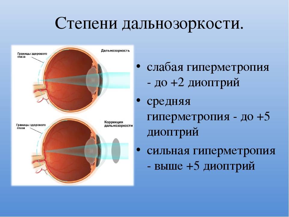 От чего на самом деле портится зрение у детей. 20 вопросов офтальмологу | правмир