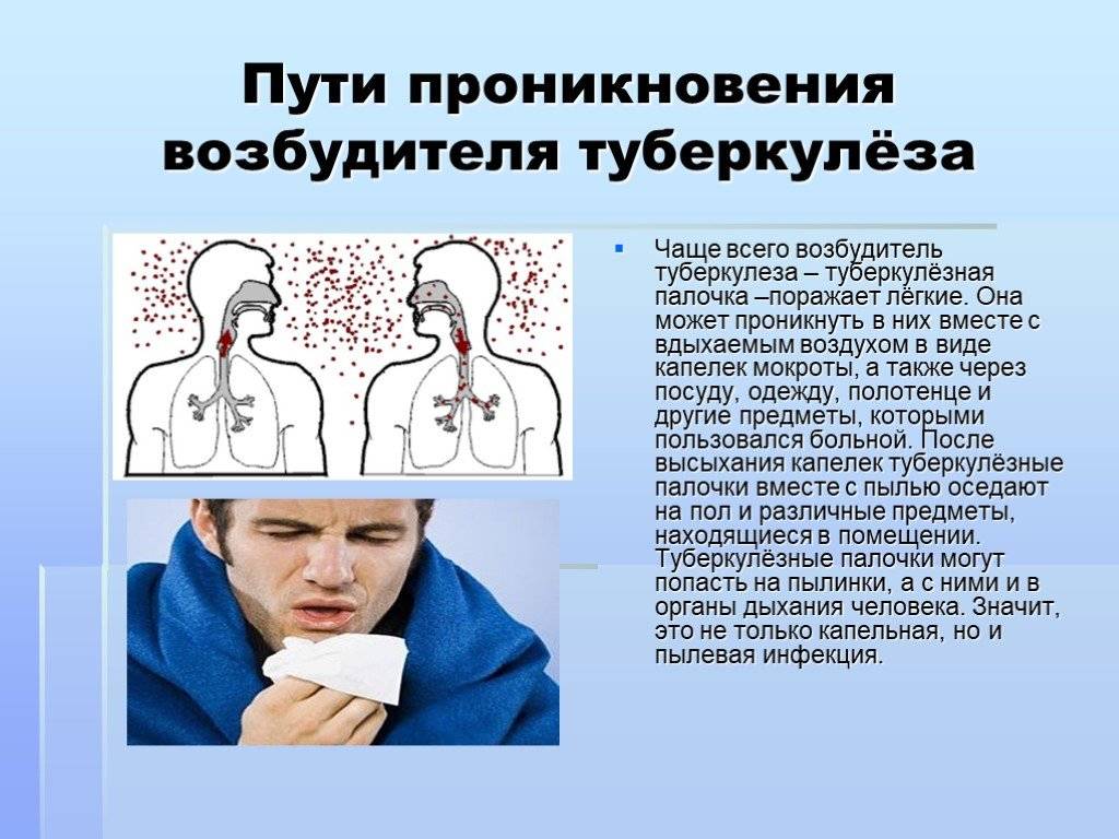 О ранних признаках и 12 клинических формах туберкулеза у детей рассказывает кандидат медицинских наук