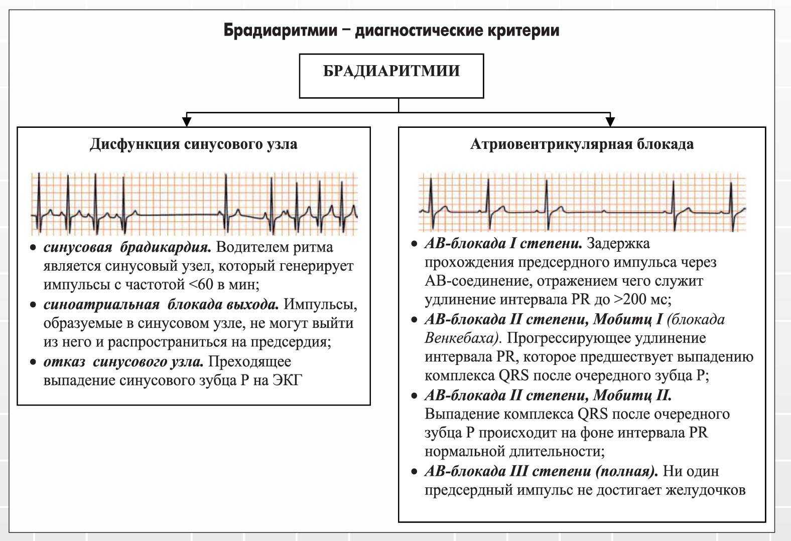 Cинусовая аритмия у ребенка: симптомы, лечение, опасно ли?