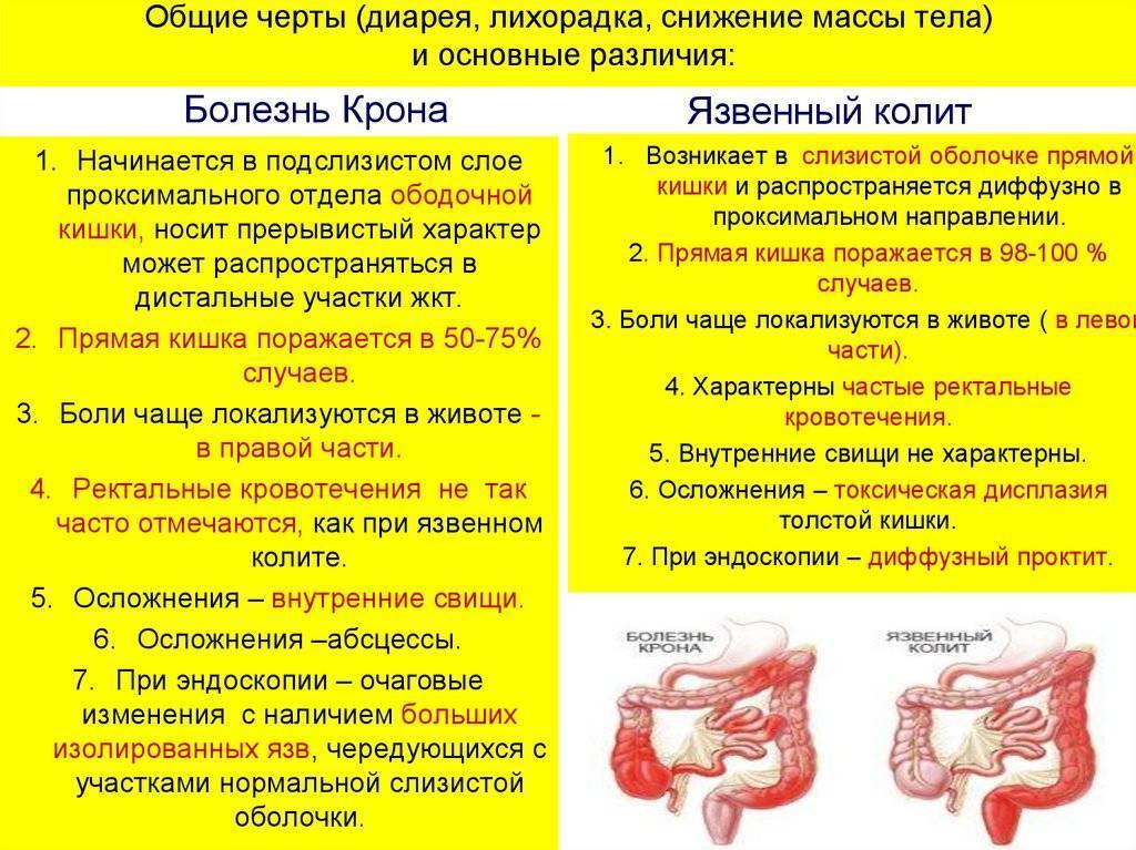 У ребенка колит: что делать?