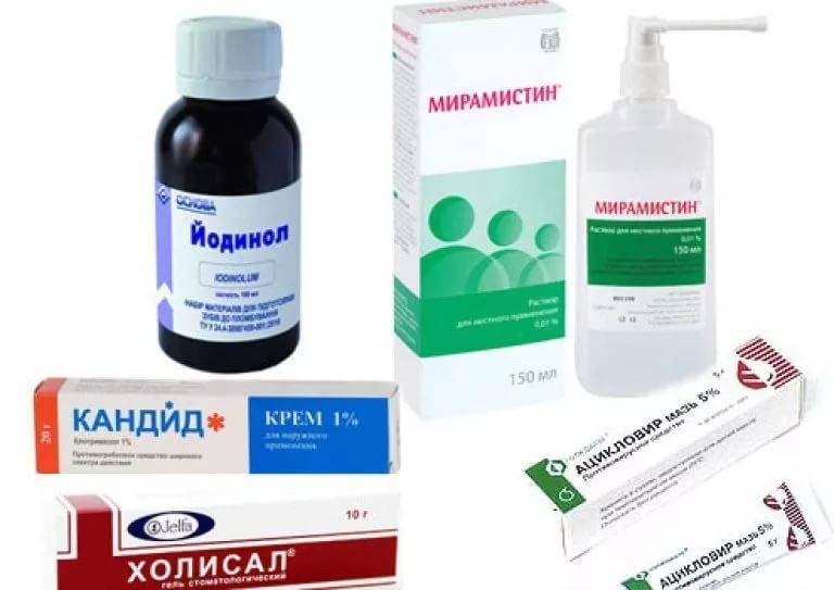 Белые язвочки во рту у ребенка с фото: почему они появляются и как лечить?