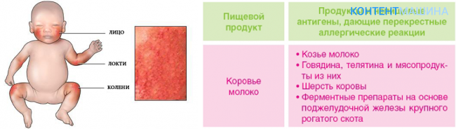 Как отличить потницу от аллергии у грудничка: советы и рекомендации | terra-baby.ru