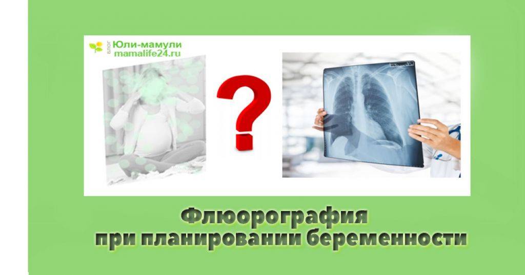 Флюорография при беременности | уроки для мам