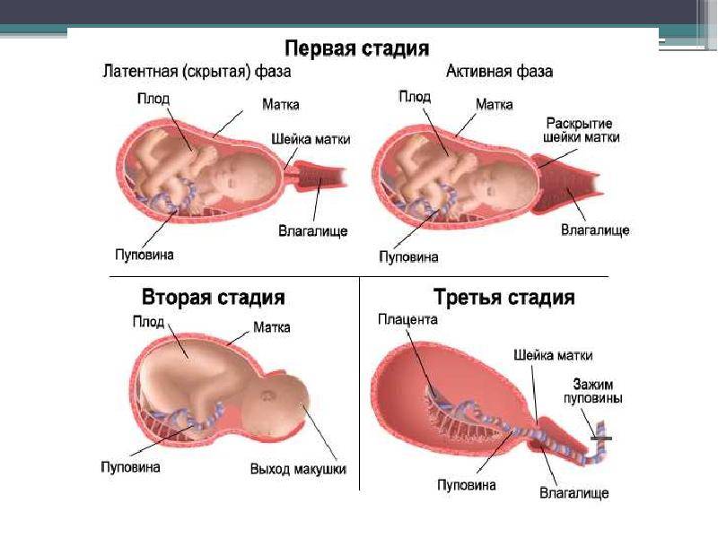 Что таят в себе третьи роды и четвертые роды, какие их отличия