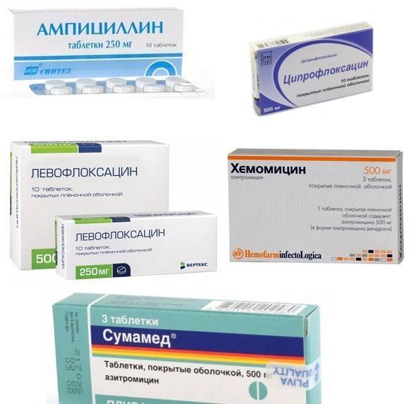 6 причин для лечения бронхита антибиотиками и обзор препаратов, которые часто назначают педиатры