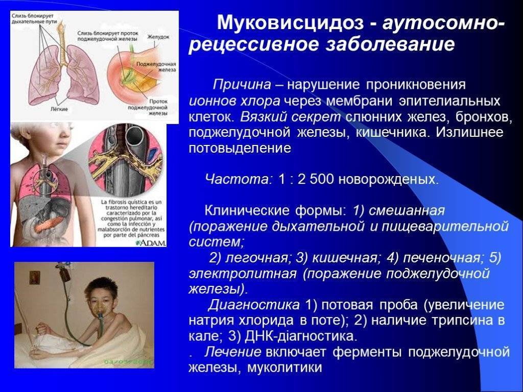 Муковисцидоз частота заболевания. Наследственное заболевание муковисцидоз.