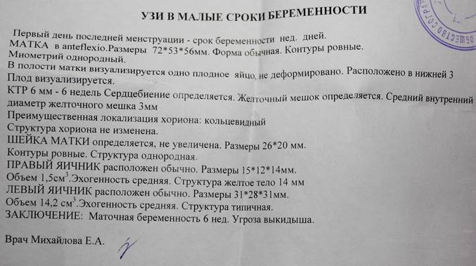 Выкидыш