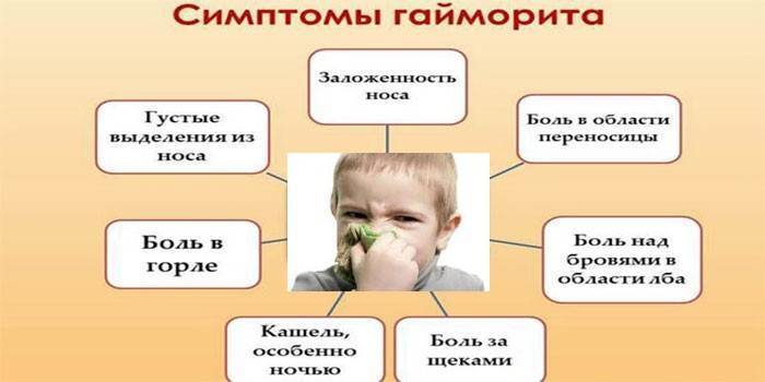 Гайморит у детей: причины, симптомы, методы лечения