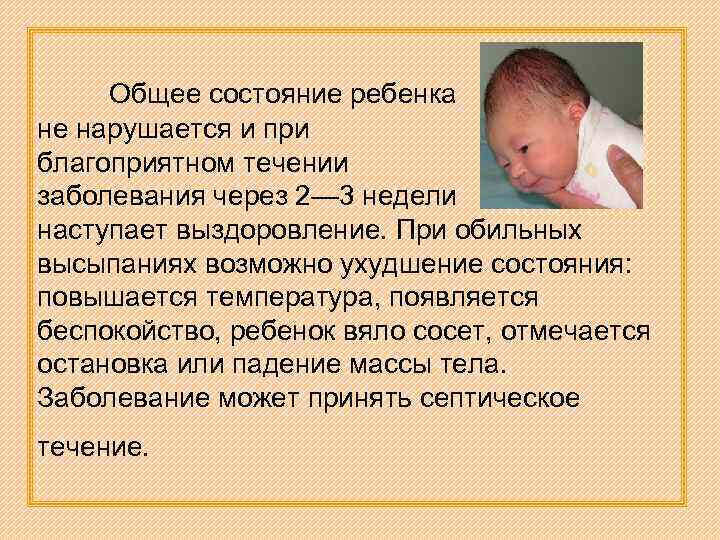 Ребенок засыпает во время кормления и не доедает грудное молоко