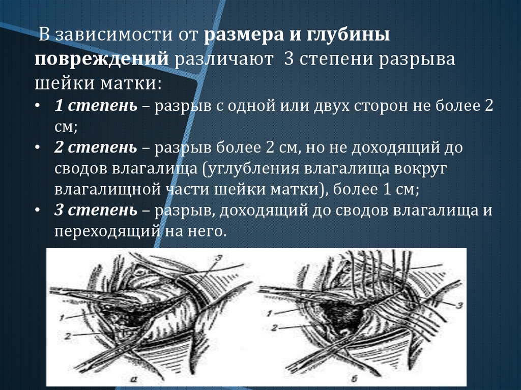 Швы после родов: виды и методы ухода