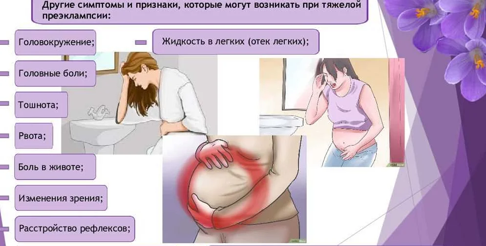 Как избавиться от токсикоза при беременности: советы для молодых мам