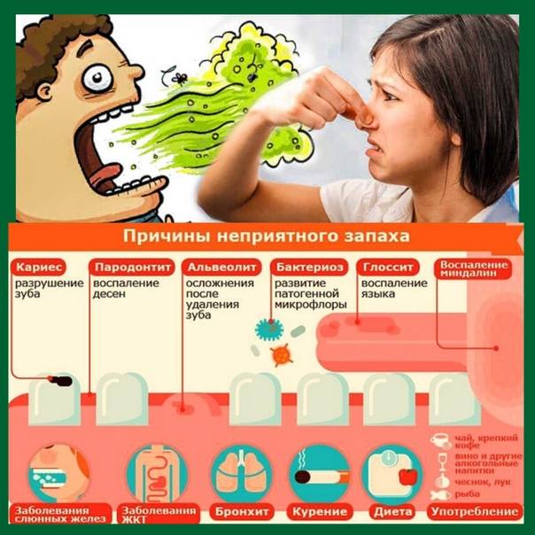 Почему у ребенка неприятный запах изо рта, какие методы помогут с ним справиться, что говорит комаровский?