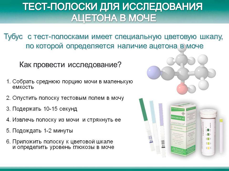Ацетон в моче у ребенка: 5 основных причин, подготовка к анализу, норма и отклонения