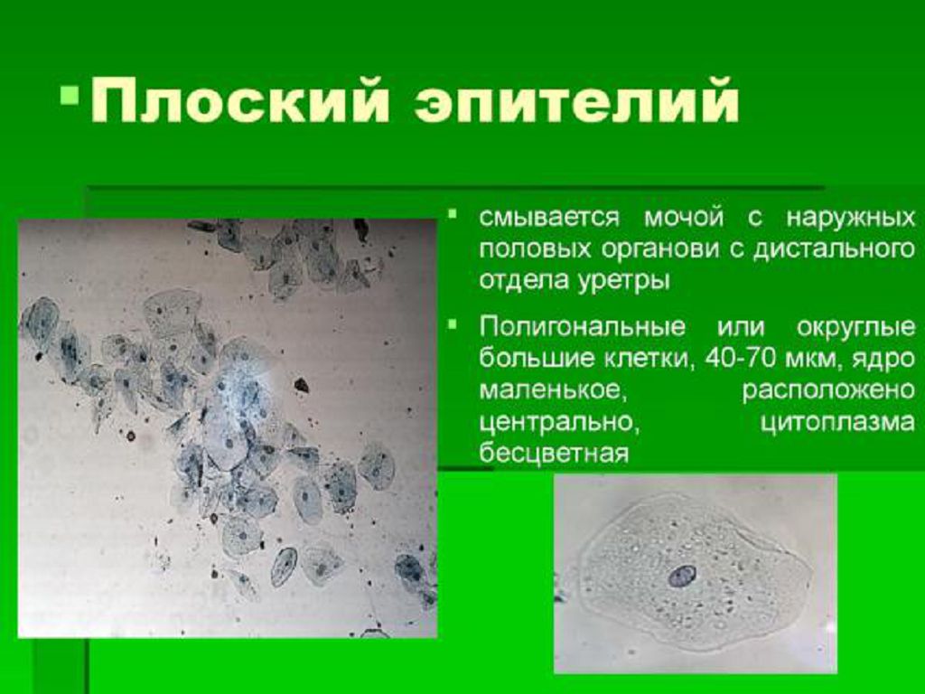 Эпителий кошки что это