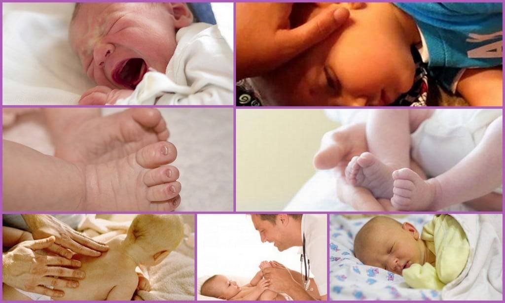 Судороги у новорожденных: причины, симптомы, лечение
