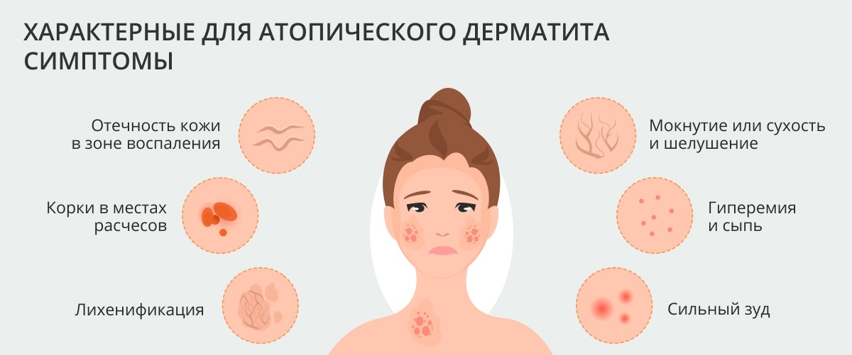 Как отличить цветение от аллергии у новорожденного: причины, особенности отличия, запреты