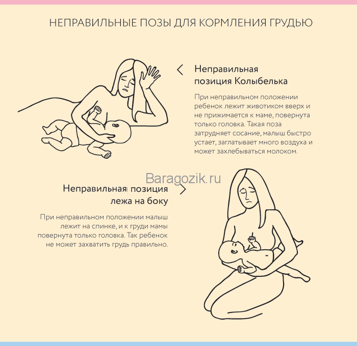 Вопрос про чередование груди - грудное вскармливание - страна мам