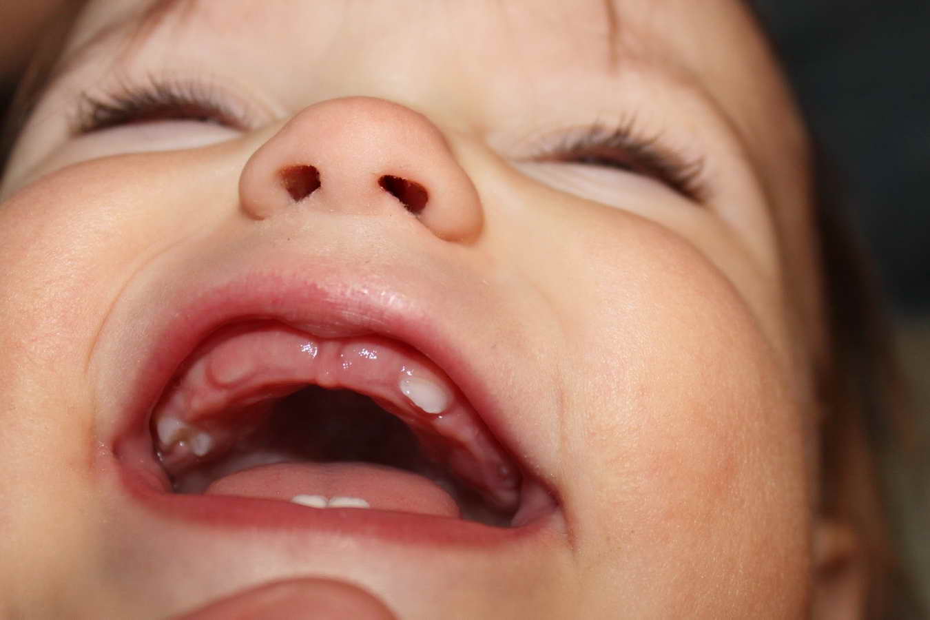 Что нужно знать родителям о прорезывании верхних зубов у детей
