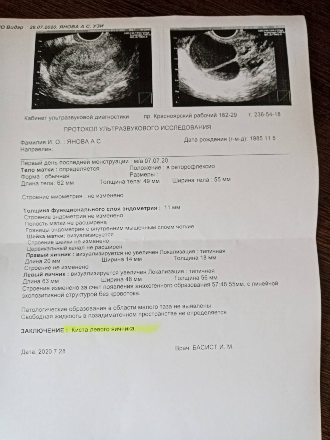 👶ответ эксперта: через сколько времени можно забеременеть после замершей беременности? 👪 как ответственно подойти к процессу планирования беременности?