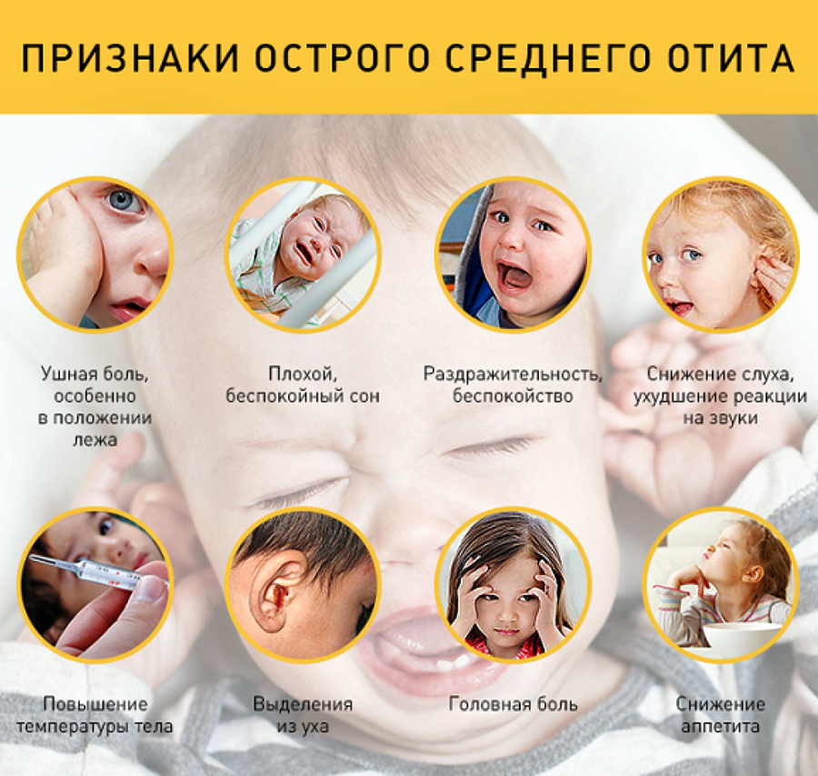 Отит у ребенка: причины, симптомы, признаки, осложнения, лечение