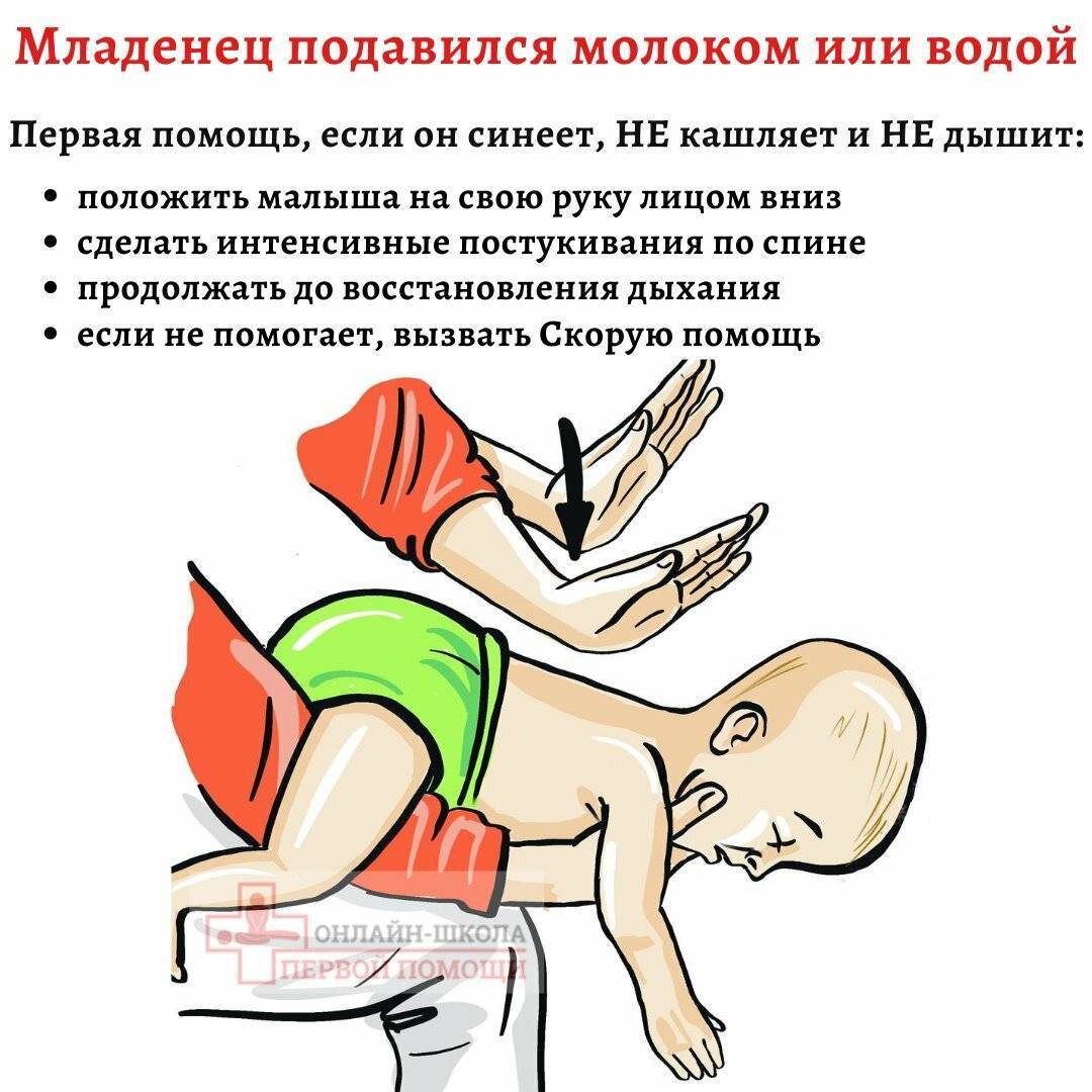 Ребенок подавился: что делать? – напоправку