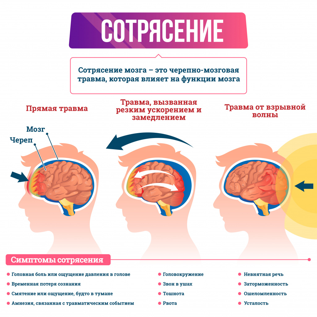 5 ведущих симптомов сотрясения мозга у ребёнка