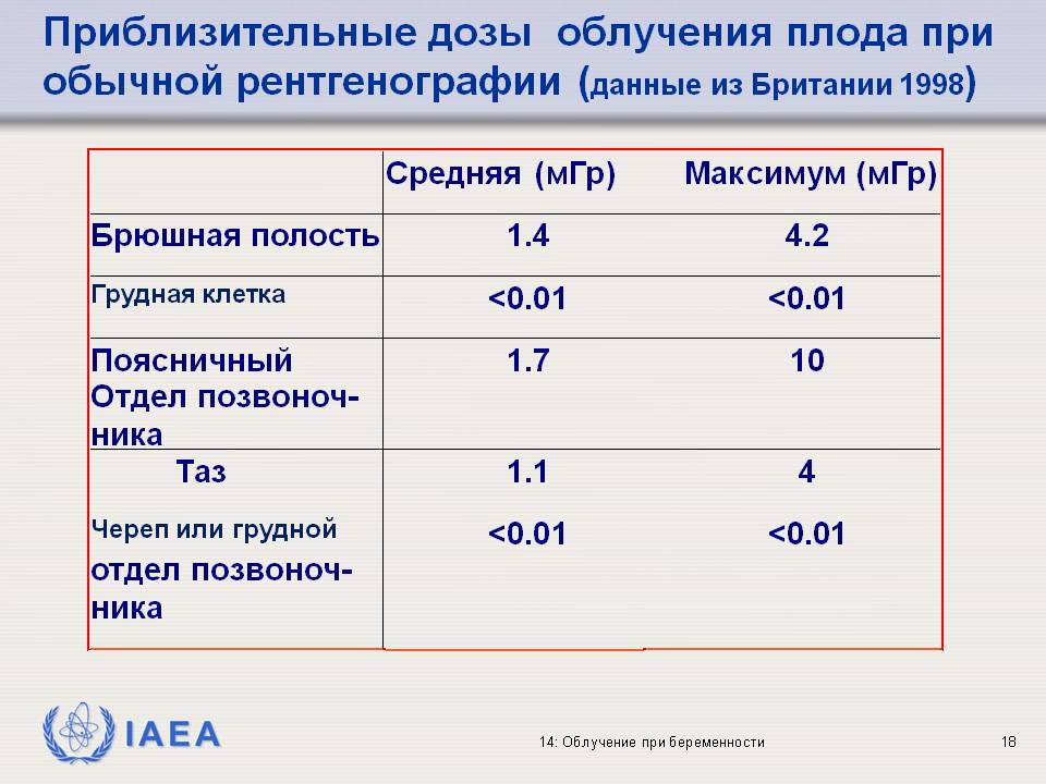 Рентген детям