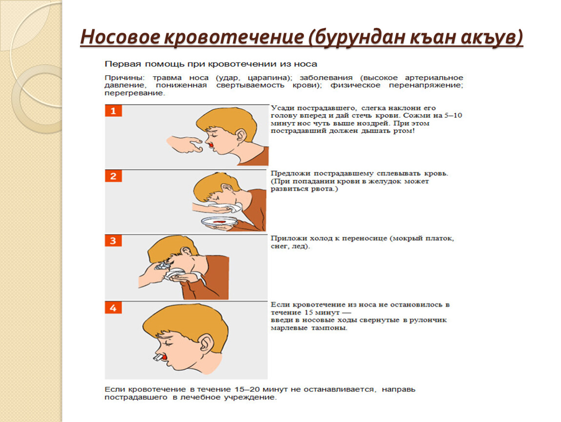 Кровь из носа у ребёнка причины