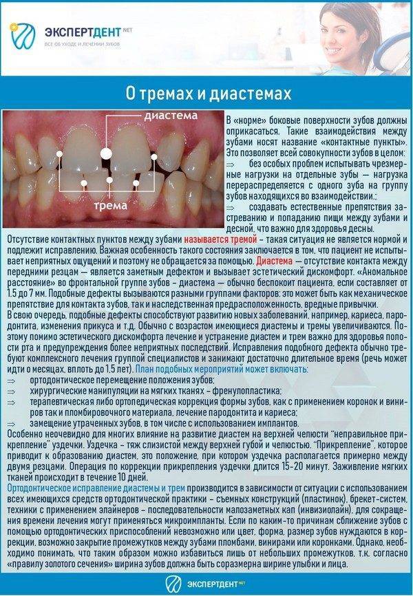Брекеты и беременность: можно ли ставить, нужно ли снимать