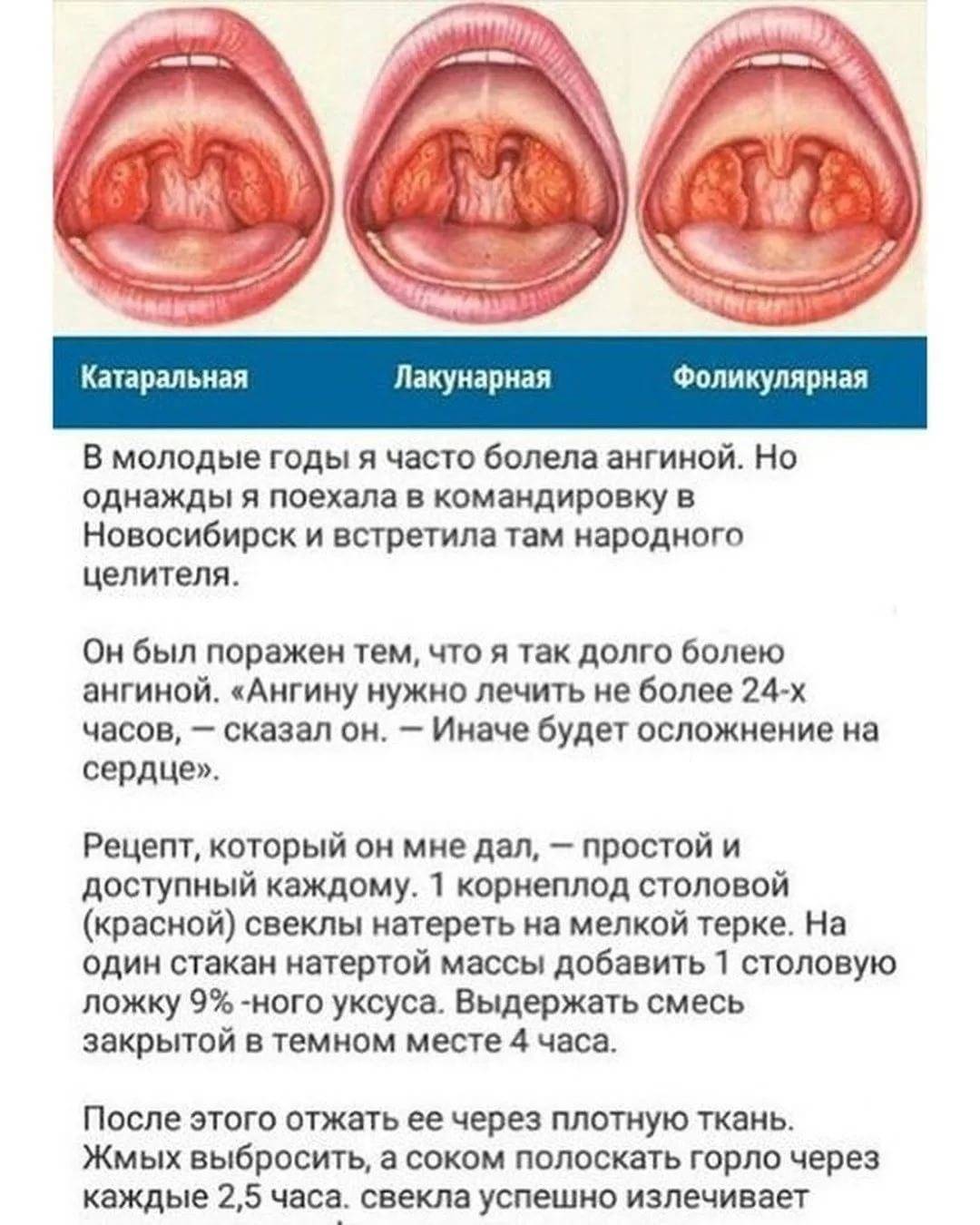 Грудничкам чем горло лечить: лечение горла у детей — что делать, если у ребенка сильная боль и красное горло — талантика — город профессий — главная