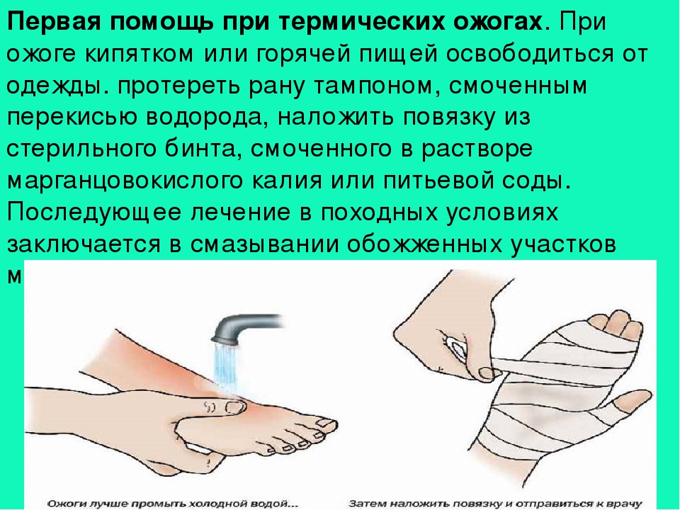Ожог у ребенка: что делать и как помочь