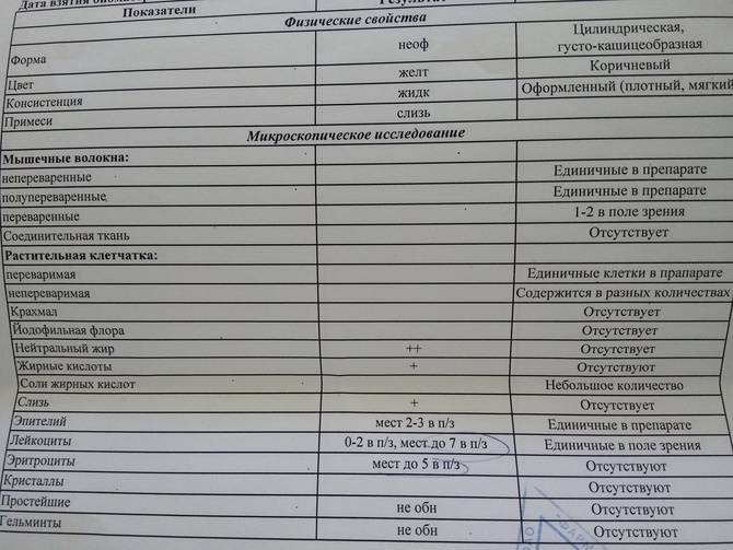 Жирные кислоты в кале у ребенка: у грудничка, новорожденного