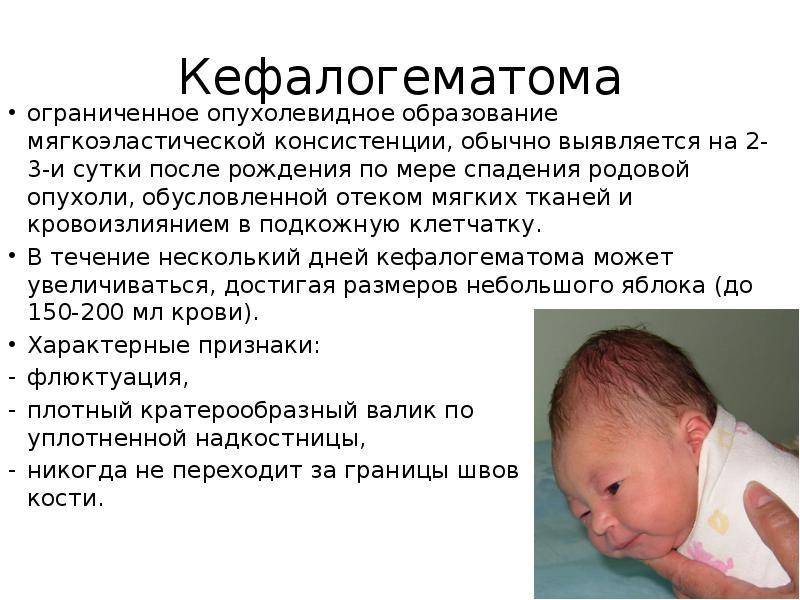 Кефалогематома новорожденных в современном акушерстве | статья в журнале «молодой ученый»