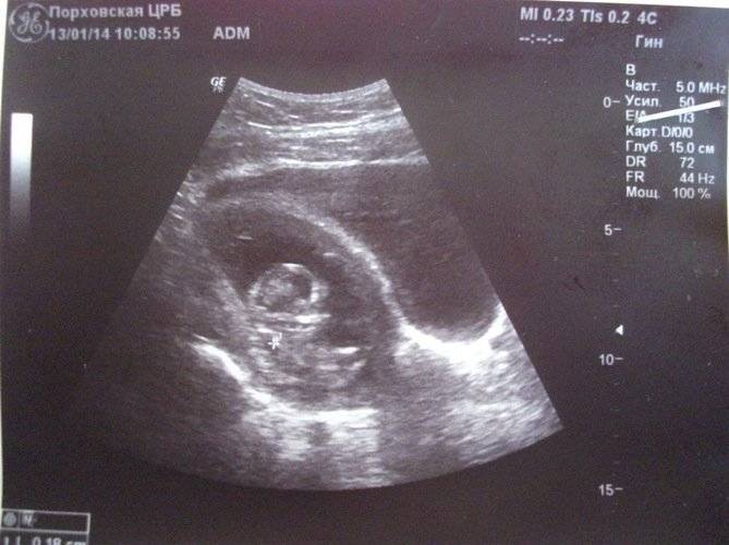 13 неделя беременности описание и фото — евромедклиник 24