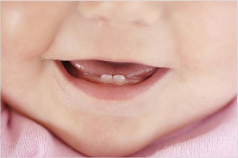 Симптомы прорезывания зубов у грудничков: что ждет родителей