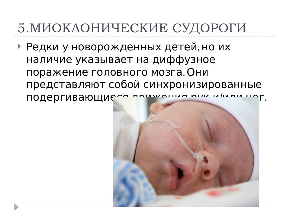 Судороги у грудничка: как проявляются, симптомы и причины | terra-baby.ru