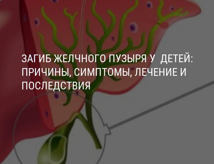 Загиб желчного пузыря у  детей: причины, симптомы, лечение и последствия