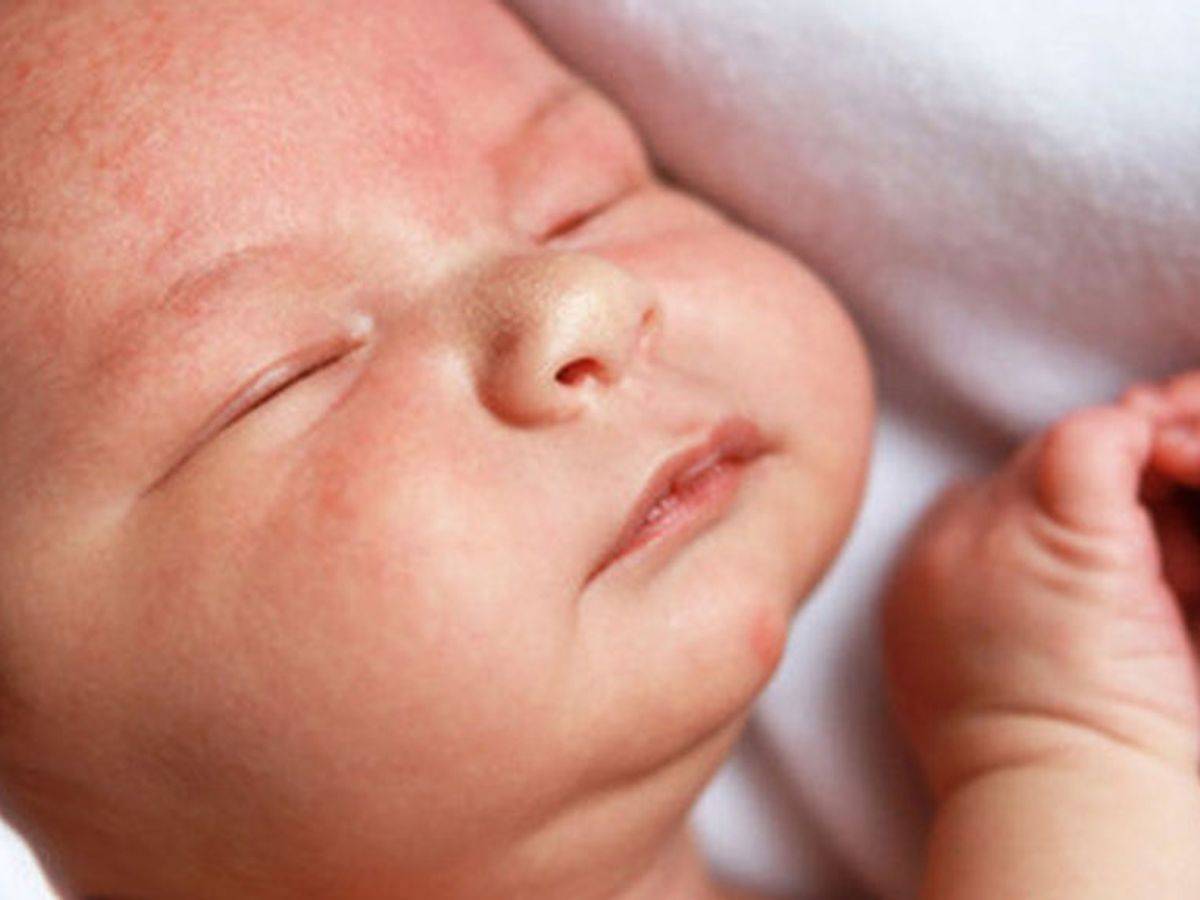 Белые прыщики на лице у новорожденного - 6 основных причин
